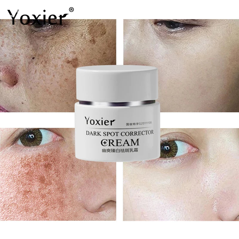 Dark Spot Correction Cream Remove Spots Body Pigmentation Face Cream Uneven Skin Tone Whitening Brightening Skin Care 30g