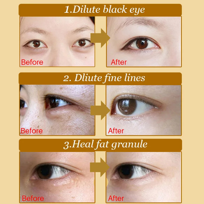 eye skin care korean cosmetics