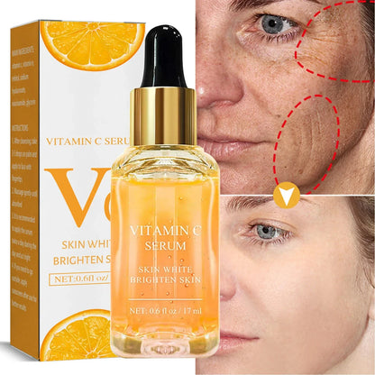 Vitamin C Remove Dark Spots Serum Whitening Freckles Fade Melanin Retinol Anti-wrinkle Essence Brightening Korean Skincare 2023