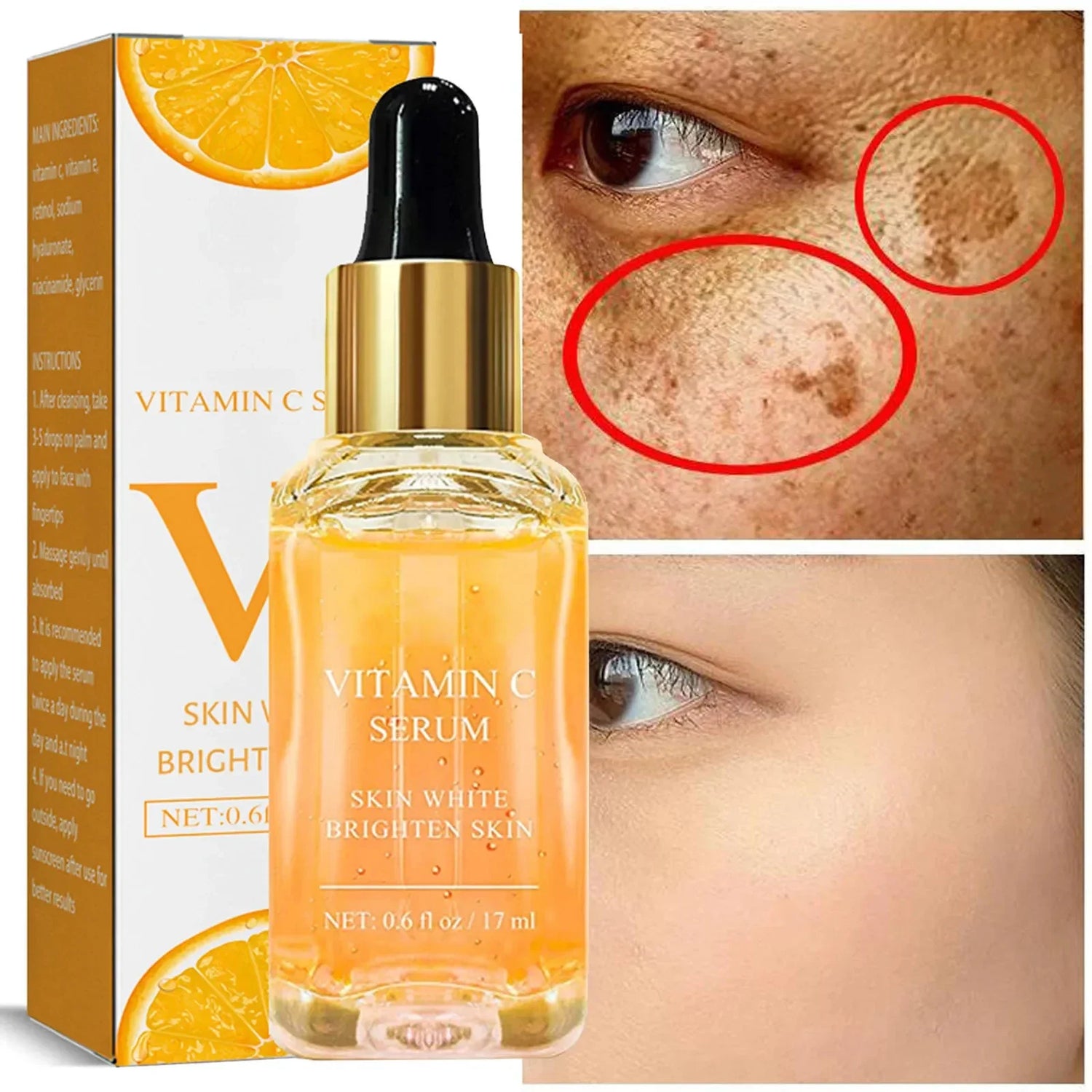 Vitamin C Remove Dark Spots Serum Whitening Freckles Fade Melanin Retinol Anti-wrinkle Essence Brightening Korean Skincare 2023