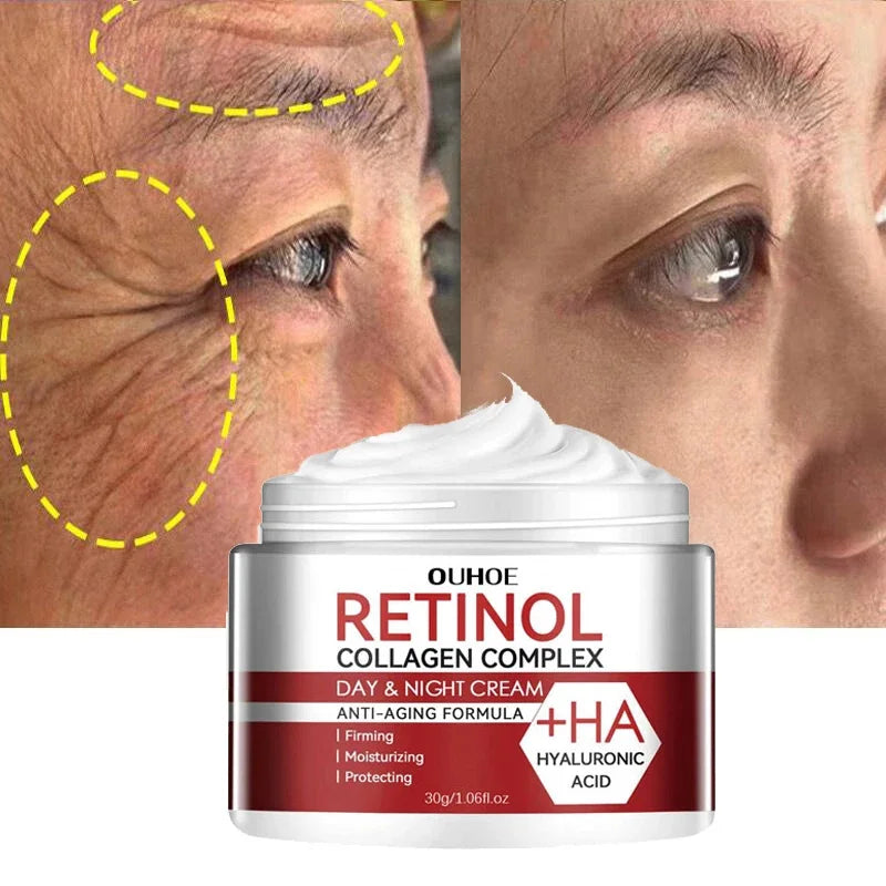 Retinol Wrinkle Remover Cream Firming Lifting Anti Aging Fade Fine Lines Gel Whitening Moisturizing Skin Care Korean Cosmetics