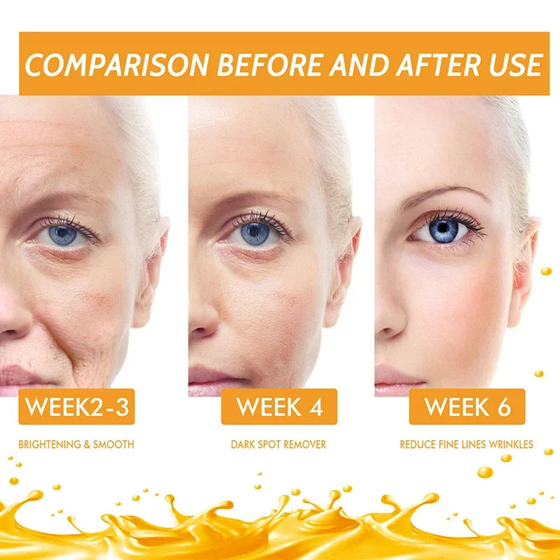 Vitamin C Remove Dark Spots Serum Whitening Freckles Fade Melanin Retinol Anti-wrinkle Essence Brightening Korean Skincare 2023