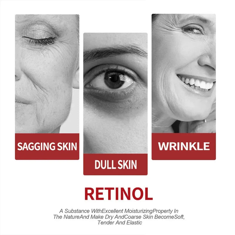 Retinol Wrinkle Remover Cream Firming Lifting Anti Aging Fade Fine Lines Gel Whitening Moisturizing Skin Care Korean Cosmetics