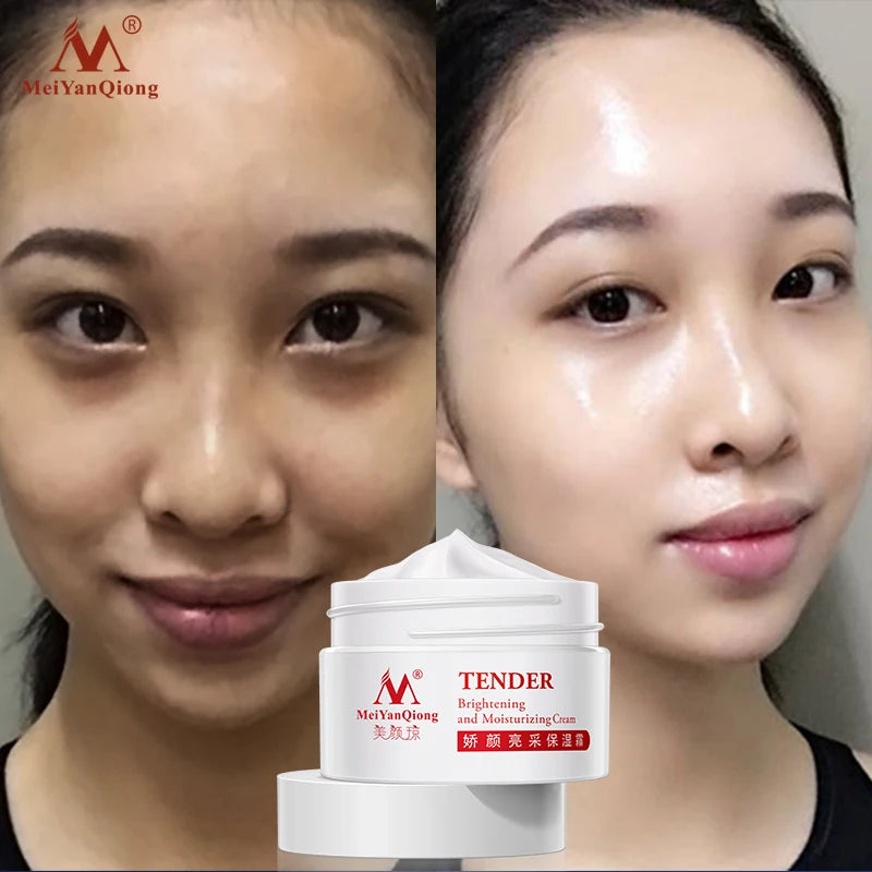 Whitening Moisturizer Whitening Wrinkle Removing Fine Lines Smoothing Skin Tenderness Firming Elasticity Anti-aging