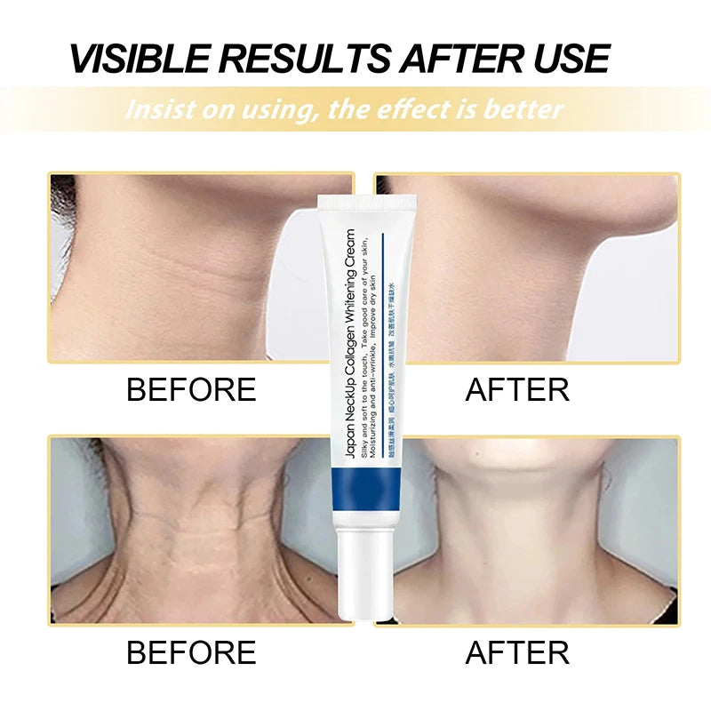 collagen neck cream anti-aging tightens lifts