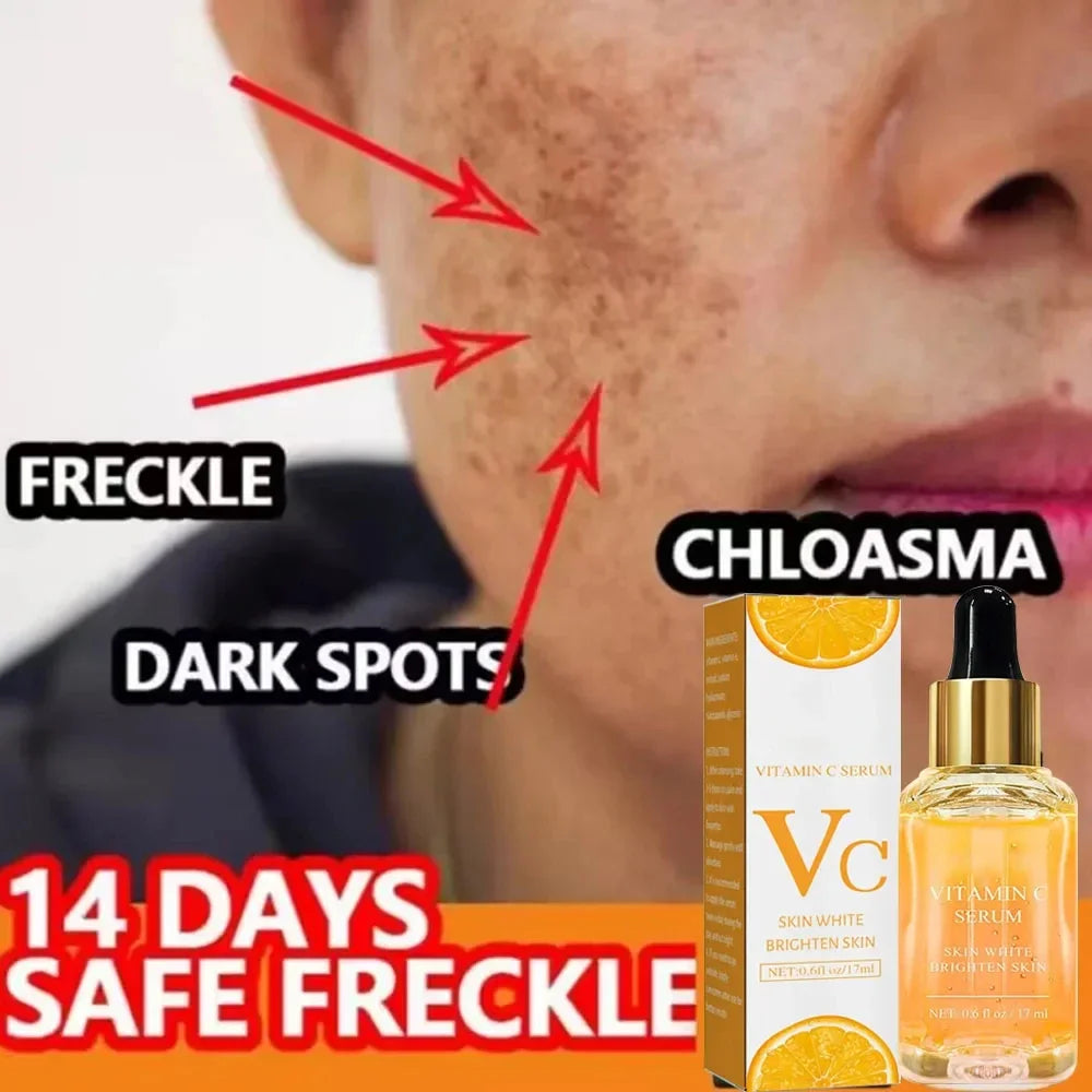 Vitamin C Remove Dark Spots Serum Whitening Freckles Fade Melanin Retinol Anti-wrinkle Essence Brightening Korean Skincare 2023