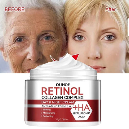 Retinol Wrinkle Remover Cream Firming Lifting Anti Aging Fade Fine Lines Gel Whitening Moisturizing Skin Care Korean Cosmetics